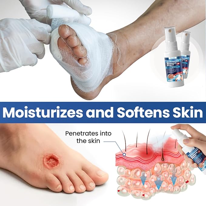 Gluco Derm Foot Shield Spray – Diabetic Skin Protection 💙🦶