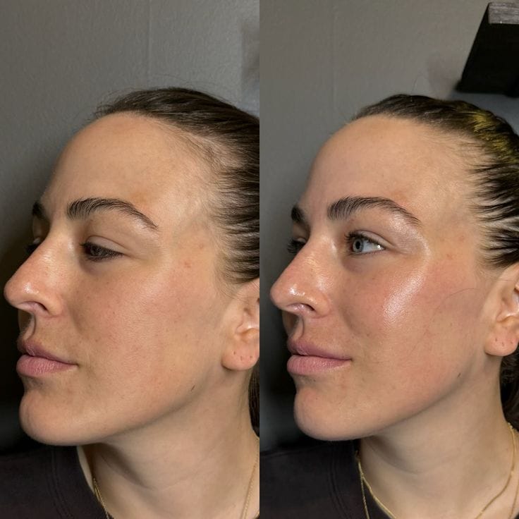 “Strong Pulse Cosmetic Wrinkle Reducer – Advanced Anti-Aging Skin Tightening Device”